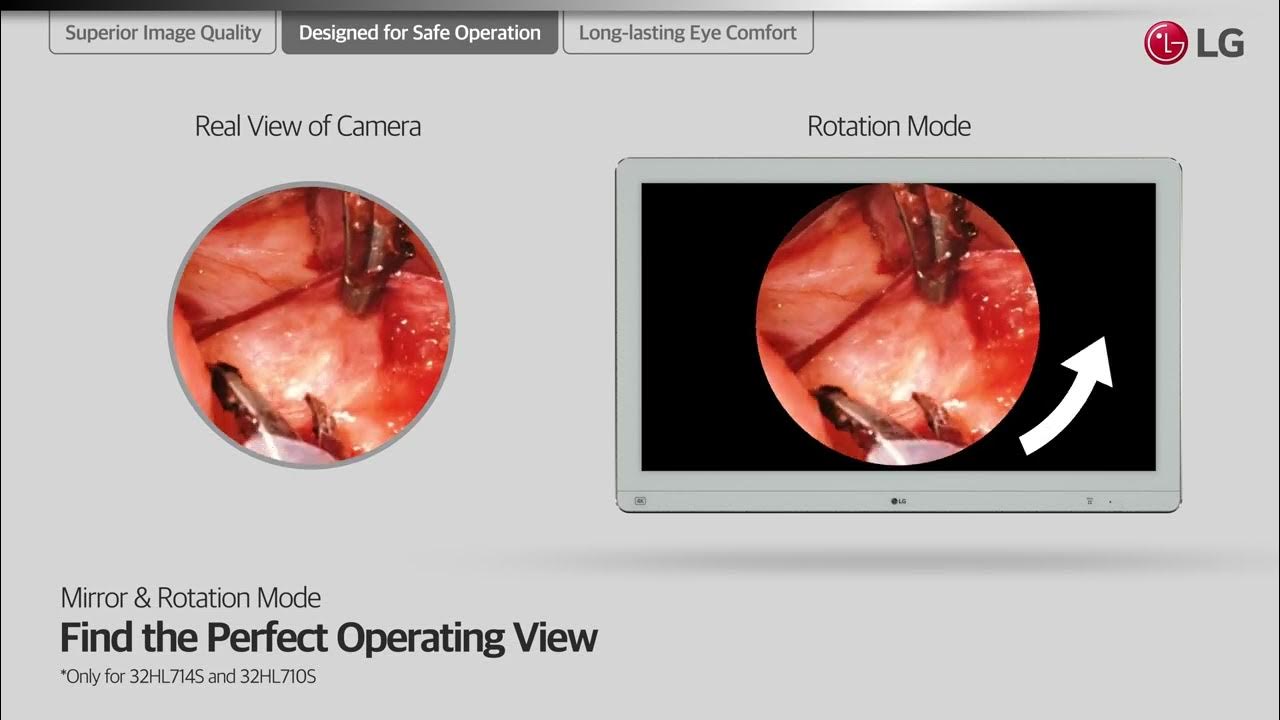 LG Surgical Monitor: 32HL714S,27HJ713S,27HJ710S, and 27HK510S