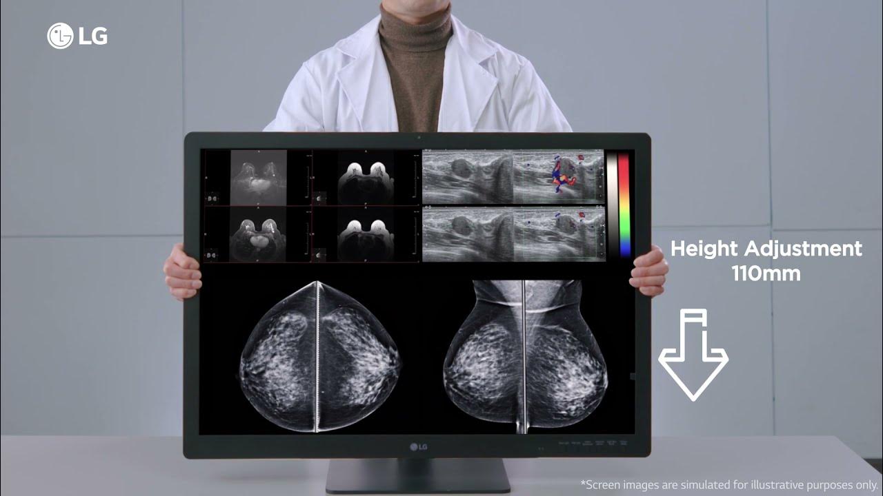 LG IT Medical Feature Overview Diagnostic Monitor 31HN713D